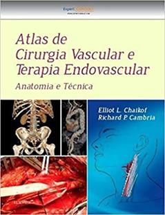 Atlas de cirurgia vascular e terapia endovascular: Anatomia e Técnica, do autor Richard Cambria