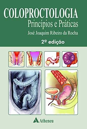 Ler Coloproctologia: Princípios e Práticas, do autor José Joaquim Ribeiro da Rocha Ler Coloproctologia: Princípios e Práticas, do autor José Joaquim Ribeiro da Rocha