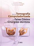 Ler Atlas de Tomografia Computadorizada por Feixe Cônico para o Cirurgião-Dentista, do autor Luiz Roberto Cappella; Reinaldo José de Oliveira; Elio Giacomo Papaiz Ler Atlas de Tomografia Computadorizada por Feixe Cônico para o Cirurgião-Dentista, do autor Luiz Roberto Cappella; Reinaldo José de Oliveira; Elio Giacomo Papaiz