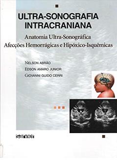 Ultra-sonografia intracraniana, do autor Nelson Abrão; Edson Amaro Junior; Giovanni Guido Cerri