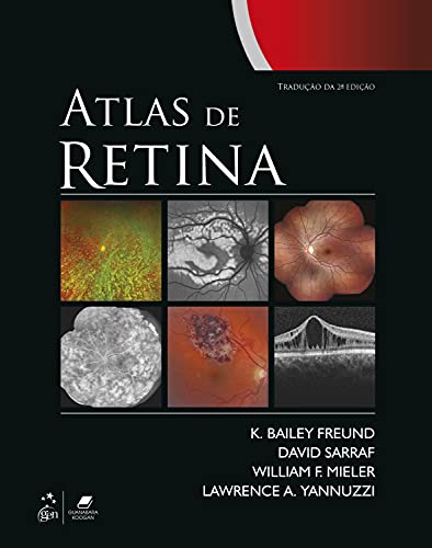 Ler Atlas de Retina, do autor K. Bailey Lawrence Yannuzzi Ler Atlas de Retina, do autor K. Bailey Lawrence Yannuzzi