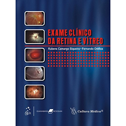 Ler Exame Clínico da Retina e Vítreo, do autor Siqueira Ler Exame Clínico da Retina e Vítreo, do autor Siqueira
