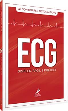 ECG SIMPLES, FÁCIL E PRÁTICO, do autor Gilson Soares Feitosa Filho