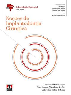 Noções de Implantodontia Cirúrgica, do autor Ricardo de Souza Magini; Cesar Augusto Magalhães Benfatti; Júlio César Matias de Souza