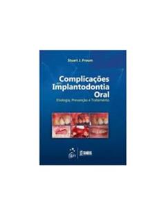 Complicações em Implantodontia Oral - Etiologia, Prevenção e Tratamento, do autor Stuart J. Froum
