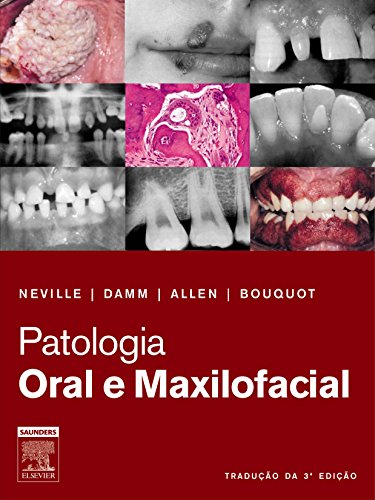 Ler Patologia Oral e Maxilofacial, do autor Allen, Carl M.^Bouquot, Jerry E.^Damm, Douglas D. Ler Patologia Oral e Maxilofacial, do autor Allen, Carl M.^Bouquot, Jerry E.^Damm, Douglas D.