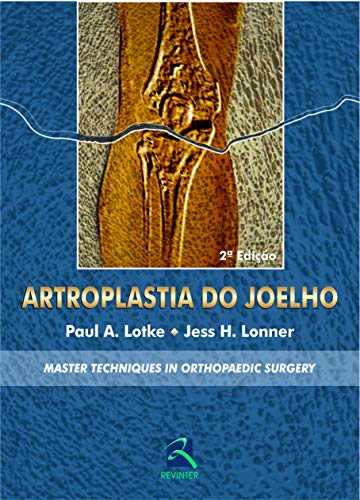 Ler Artroplastia do Joelho: Master Techniques In Orthopaedic Surgery, do autor Paul A. Lotke; Jess H. Lonner