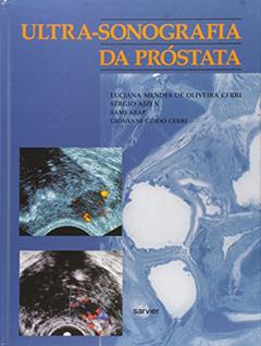 Ultra Sonografia Da Prostata, do autor Cerri Giovanni Guido