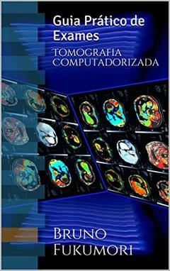 Tomografia Computadorizada: Guia Prático de Exames, do autor Bruno Fukumori