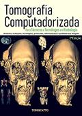 Ler Tomografia Computadorizada: Para Técnicos e Tecnólogos em Radiologia (1), do autor Prof Todescatto Ler Tomografia Computadorizada: Para Técnicos e Tecnólogos em Radiologia (1), do autor Prof Todescatto