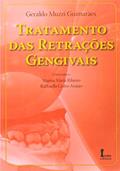 Ler Tratamento das Retrações Gengivais, do autor Geraldo Muzzi Guimarães; Marisa Maria Ribeiro; Rafhaella Cedro Araújo