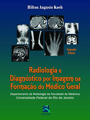 Ler Radiologia e Diagnóstico por Imagem na Formação do Médico Geral: Departamento de Radiologia da Faculdade de Medicina da UFRJ, do autor Hilton Augusto Koch Ler Radiologia e Diagnóstico por Imagem na Formação do Médico Geral: Departamento de Radiologia da Faculdade de Medicina da UFRJ, do autor Hilton Augusto Koch