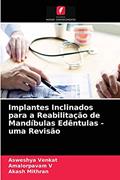 Ler Implantes Inclinados para a Reabilitação de Mandíbulas Edêntulas - uma Revisão, do autor Asweshya Venkat; Amalorpavam V; Akash Mithran Ler Implantes Inclinados para a Reabilitação de Mandíbulas Edêntulas - uma Revisão, do autor Asweshya Venkat; Amalorpavam V; Akash Mithran