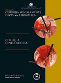 Ler Atlas de Cirurgia Minimamente Invasiva e Robótica: Cirurgia Ginecológica, do autor Mariano T. Gomes; Renato M. Marques Ler Atlas de Cirurgia Minimamente Invasiva e Robótica: Cirurgia Ginecológica, do autor Mariano T. Gomes; Renato M. Marques