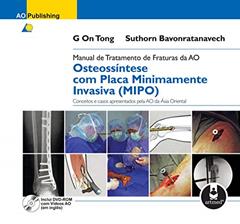 Manual de Tratamento de Fraturas da AO: Osteossíntese com Placa Minimamente Invasiva (MIPO), do autor G On Tong