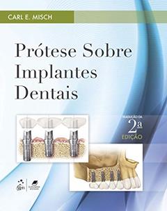 Prótese sobre Implantes Dentais, do autor Carl E. Misch