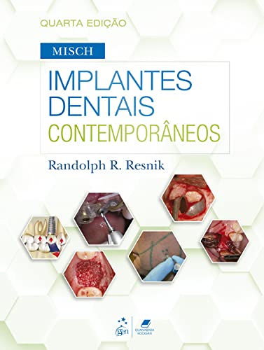 Ler Misch - Implantes Dentais Contemporâneos, do autor Randolph R. Resnik Ler Misch - Implantes Dentais Contemporâneos, do autor Randolph R. Resnik