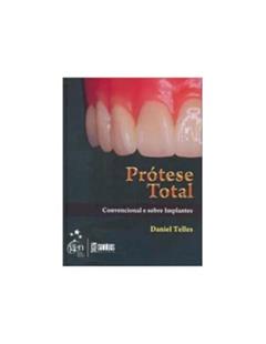 Prótese Total - Convencional e Sobre Implantes, do autor Telles
