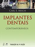 Ler Implantes Dentais Contemporâneos, do autor Carl Carl Misch Ler Implantes Dentais Contemporâneos, do autor Carl Carl Misch